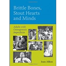 Brittle Bones, Stout Hearts And Minds: Adults With Osteogenesis Imperfecta الكتب الأجنبية