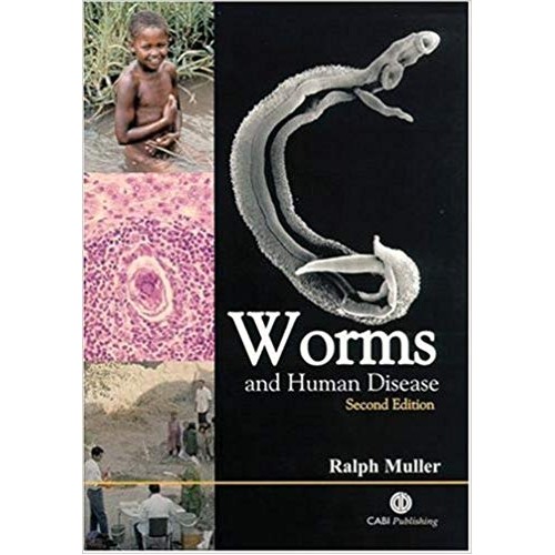 Worms and Human Disease  الكتب الأجنبية