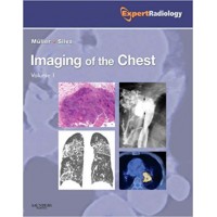 Imaging of the Chest,